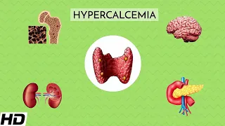 Hypercalcaemia: Everything You Need to Know