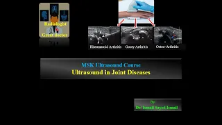 Ultrasound in Joint Diseases (for Radiology Residents)