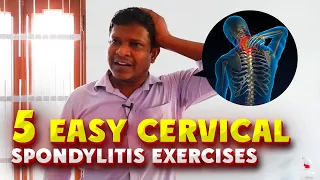 Stop Neck Pain Now! 5 Easy Cervical Spondylitis Exercises| सर्वाइकल स्पोंडिलाइटिस