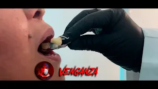 EL DENTISTA DEL TERROR SEGUNDA TEMPORADA. CAPÍTULO 1, " LA PRÓTESIS DE LA MUERTE "