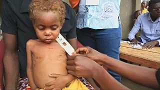 400 тысяч детей в ДР Конго стоят перед лицом голодной смерти (новости)