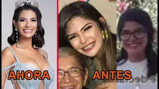 Así se veía la ganadora de Miss Universo 2023 antes de operarse; Miss Nicaragua Sheynnis Palacios