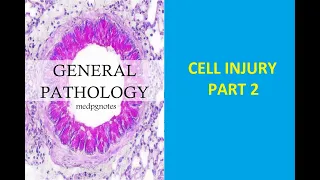 GENERAL PATHOLOGY II CHAP 2 II CELL INJURY II PART 2 II ROBBINS  PATHOLOGY