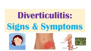 Diverticulitis Signs & Symptoms (And Why They Occur)