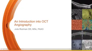 Introduction to OCT Angiography