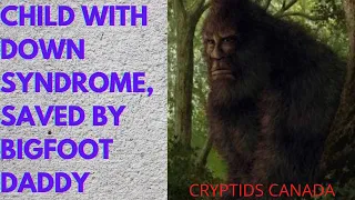 CC EPISODE 385 CHILD WITH DOWN SYNDROME SAVED BY BIGFOOT DADDY