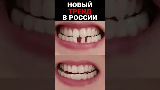 Россияне ремонтируют зубы дома #новости #события #новостироссии