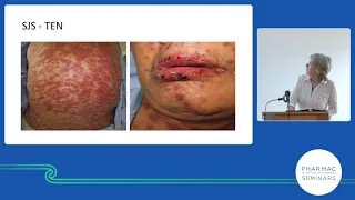 PHARMAC seminar: Dermatology update, acute rashes part 2