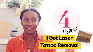 Amazing Laser Tattoo Removal Results!