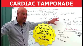 Cardiac Tamponade - Causes, Symptoms & Treatment.