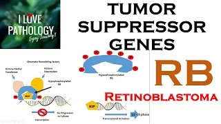 NEOPLASIA 3: TUMOR SUPPRESSOR GENES: Retinoblastoma Gene, Knudson's Two Hit Hypothesis.