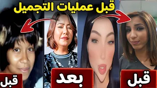 لن تصدق شكل الفنانات العرب قبل عمليات التجميل | ستنصدم من  شكلهم