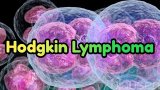 Hodgkin Lymphoma (updated 2023) - CRASH! Medical Review Series