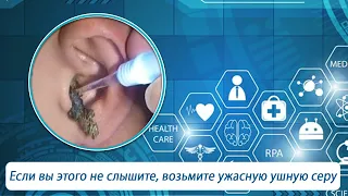 Если вы этого не слышите, возьмите ужасную ушную серу-Earwax Remove