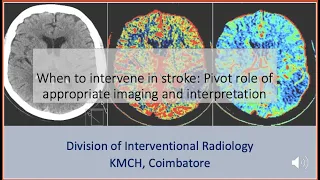 Imaging and decision making in stroke