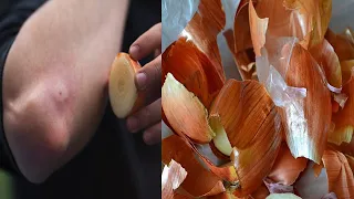 Stop throwing onion peels: You'll Never Throw Away Onion Skin After Watching This