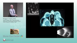 Ocular Echography for Intraocular Tumors (Part 2)