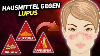 9 Natürliche Hausmittel gegen Lupus