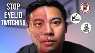 How to get rid of EYELID TWITCHING | @MichaelRChuaMD