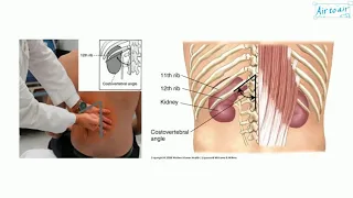 Mayo-Robson's symptom