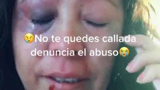 TikTok- Denuncia el abuso.