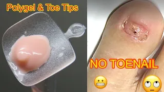 Polygel & Toe Tips - Get a Toenail Easy