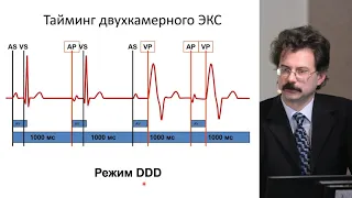 Холтеровское мониторирование пациентов со стимулятором. Часть 1: особенности заключения