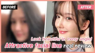 [Grand Plastic Surgery] Discovery of My Ideal Profile