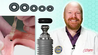 How to Replace Denture O-Rings for Ball Abutment Attachments