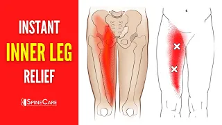 How to Fix Inner Leg Pain FOR GOOD