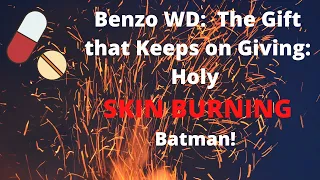Benzo WD:  This SKIN is on Fire!  #xanax #benzos #benzodiazepines
