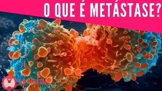 O que é metástase? | Dr Jônatas Catunda