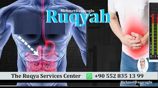 Ruqya, Ruqyah To Remove Magic, Evil eye  & Jinn Possession ,  Live Session , Online Ruqyah Services