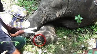 Poor Elephant's Foot was Rotting away, kind people were their to treat the painful wound