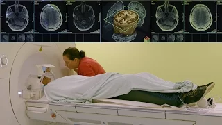Understanding the OCD Brain part 3 : Inside a patient's head