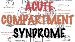 Compartment Syndrome - Overview (signs and symptoms, pathophysiology, treatment)