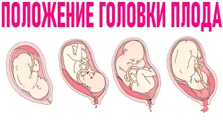 НИЗКОЕ ПОЛОЖЕНИЕ ГОЛОВКИ ПЛОДА ВО ВРЕМЯ БЕРЕМЕННОСТИ | Когда головка ребенка должна опуститься в таз