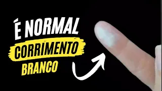 Corrimento branco é normal?  / Dr Michel Palheta e  @DraRobertaSeveriano #corrimentobranco #corrimento