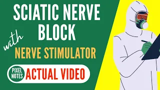 ACTUAL Sciatic Nerve Block | Using Nerve Stimulator | Landmark Technique