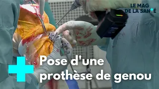 Prothèse de genou : une chirurgie de haute technologie - Le Magazine de la Santé