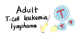 Adult T- cell Leukemia/ Lymphoma