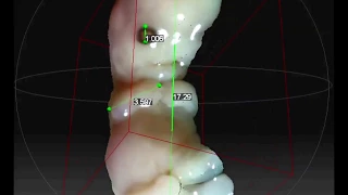 эмбрион человека в 3D