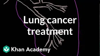 Lung cancer treatment | Respiratory system diseases | NCLEX-RN | Khan Academy