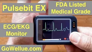 Wellue Pulsebit™EX "Personal ECG/EKG Monitor" Large Color Display & electro pads: Unboxing & Review