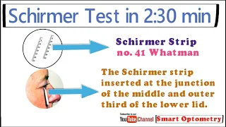 Schirmer test - Dry Eye within 2:30 min
