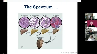 Part 1 Non alcoholic Fatty Liver Disease in Children