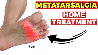 BEST Metatarsalgia Exercises, Massage & Stretches[2022 HOME Treatment]