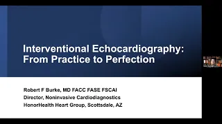 Interventional Echocardiography: From Practice to Perfection