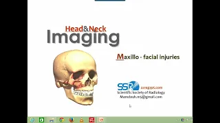 Imaging of Maxillofacial trauma (DRE) Prof. Mamdouh Mahfouz