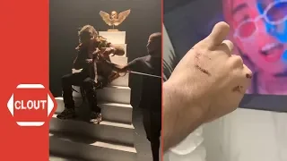 Lil Pump Gets Bitten by Snake While Shooting Music Video